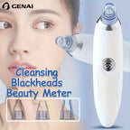 Medidor de belleza GENAI para limpieza de puntos negros - Limpiador portátil de poros faciales con 4 sondas, limpieza suave y segura para hombres y mujeres, funciona con pilas (pilas no incluidas)
