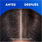 Pack Champús H&S Anticaspa HS (400ml)x2 – Protección Eficaz Contra la Caspa, Dermatológicamente Testado, Clínicamente Probado, Cuida tu Cabello y Cuero Cabelludo