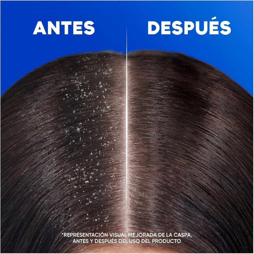 Pack Champús H&S Anticaspa HS (400ml)x2 – Protección Eficaz Contra la Caspa, Dermatológicamente Testado, Clínicamente Probado, Cuida tu Cabello y Cuero Cabelludo