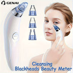 Medidor de belleza GENAI para limpieza de puntos negros - Limpiador portátil de poros faciales con 4 sondas, limpieza suave y segura para hombres y mujeres, funciona con pilas (pilas no incluidas)