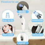 Medidor de belleza GENAI para limpieza de puntos negros - Limpiador portátil de poros faciales con 4 sondas, limpieza suave y segura para hombres y mujeres, funciona con pilas (pilas no incluidas)