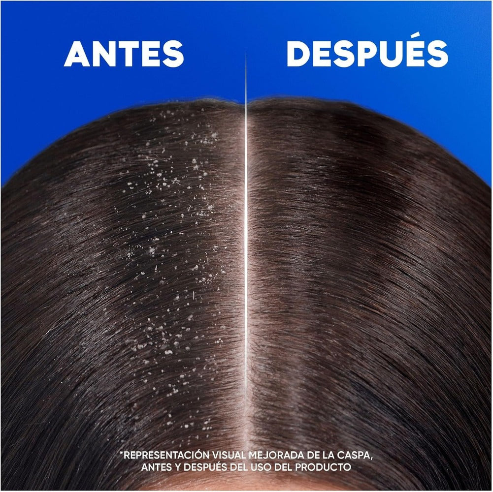 Pack Champús H&S Anticaspa HS (400ml)x2 – Protección Eficaz Contra la Caspa, Dermatológicamente Testado, Clínicamente Probado, Cuida tu Cabello y Cuero Cabelludo